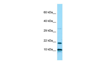 IL26 Rabbit Polyclonal Antibody