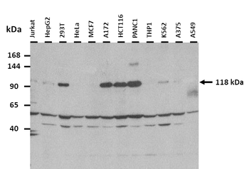 SYNPO2 Rabbit Polyclonal Antibody