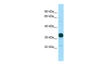 NPBWR1 Rabbit Polyclonal Antibody