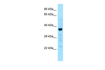 CAPZA1 Rabbit Polyclonal Antibody