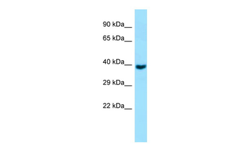 GNA11 Rabbit Polyclonal Antibody