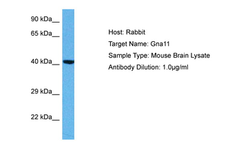 GNA11 Rabbit Polyclonal Antibody