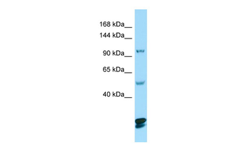 CTNND2 Rabbit Polyclonal Antibody