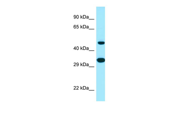 SCD5 Rabbit Polyclonal Antibody
