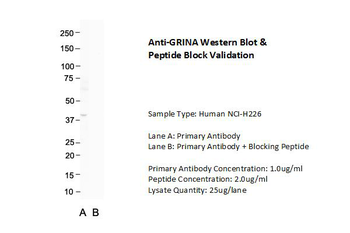 GRINA Rabbit Polyclonal Antibody