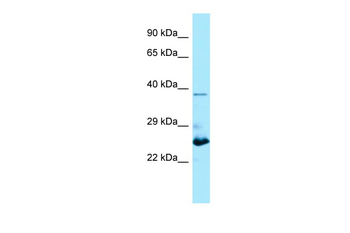 MOB1B Rabbit Polyclonal Antibody