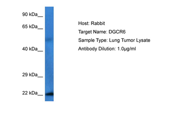 DGCR6 Rabbit Polyclonal Antibody