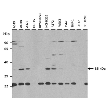 OR51E2 Rabbit Polyclonal Antibody