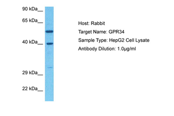 GPR34 Rabbit Polyclonal Antibody