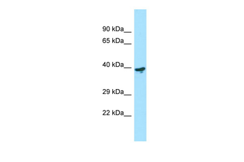 LYPD3 Rabbit Polyclonal Antibody