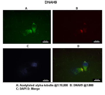 DNAH9 Rabbit Polyclonal Antibody
