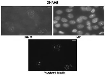 DNAH9 Rabbit Polyclonal Antibody