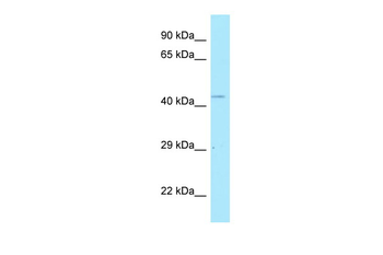 POLDIP2 Rabbit Polyclonal Antibody