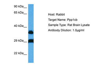 PPP1CB Rabbit Polyclonal Antibody