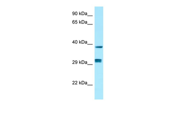 PPP1CB Rabbit Polyclonal Antibody