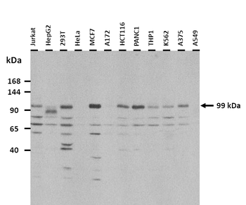 BBS9 Rabbit Polyclonal Antibody