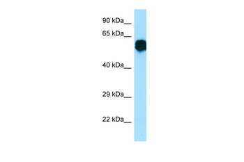 CR1L Rabbit Polyclonal Antibody