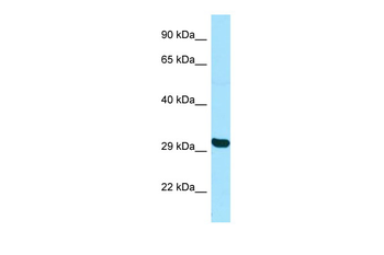 TBPL2 Rabbit Polyclonal Antibody