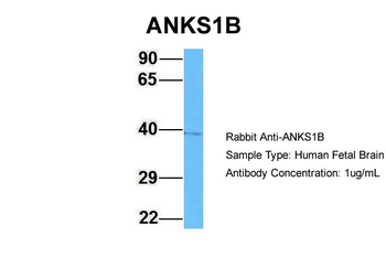 ANKS1B Rabbit Polyclonal Antibody