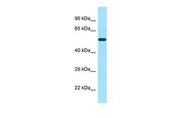 POTEA Rabbit Polyclonal Antibody