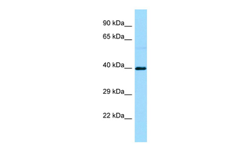 S1PR3 Rabbit Polyclonal Antibody