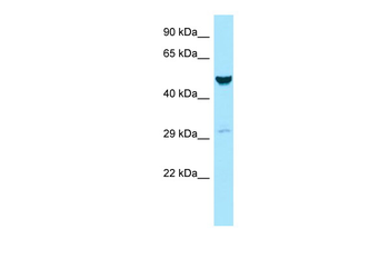 GALK2 Rabbit Polyclonal Antibody