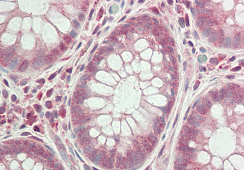 BICRA Rabbit Polyclonal Antibody