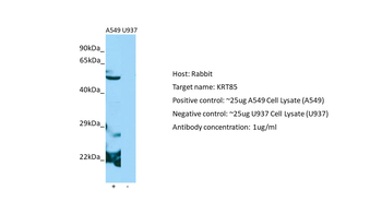 KRT85 Rabbit Polyclonal Antibody
