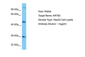 KRT85 Rabbit Polyclonal Antibody