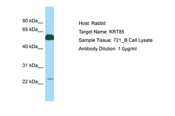 KRT85 Rabbit Polyclonal Antibody