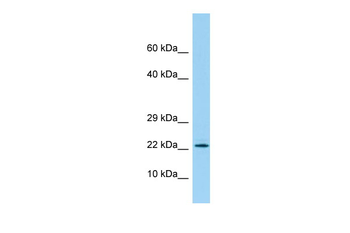 PBOV1 Rabbit Polyclonal Antibody