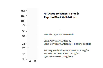 RAB30 Rabbit Polyclonal Antibody