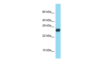 Spaca3 Rabbit Polyclonal Antibody