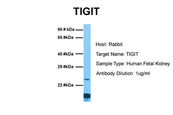 TIGIT Rabbit Polyclonal Antibody