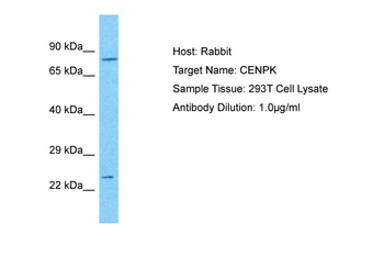 CENPK Rabbit Polyclonal Antibody