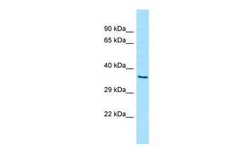 D2HGDH Rabbit Polyclonal Antibody
