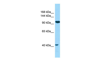 CILP2 Rabbit Polyclonal Antibody