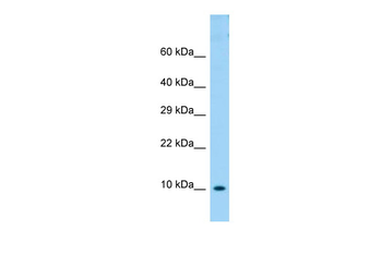 COX6B1 Rabbit Polyclonal Antibody