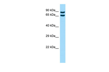 CPNE8 Rabbit Polyclonal Antibody