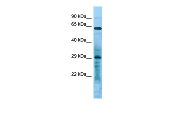 LRRC10 Rabbit Polyclonal Antibody