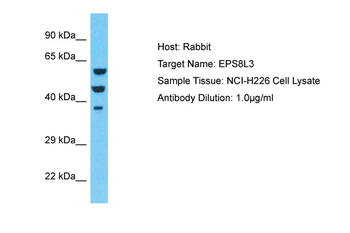 EPS8L3 Rabbit Polyclonal Antibody