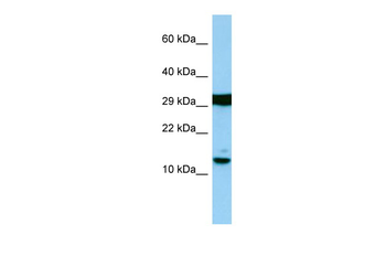 H2AFJ Rabbit Polyclonal Antibody