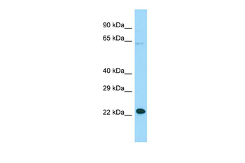 MOSPD1 Rabbit Polyclonal Antibody