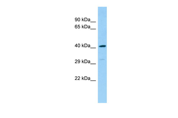 DEF8 Rabbit Polyclonal Antibody