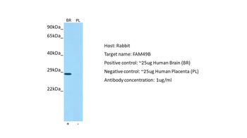 FAM49B Rabbit Polyclonal Antibody
