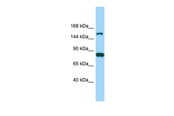 IQSEC2 Rabbit Polyclonal Antibody