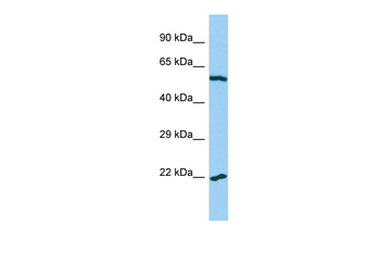 MRPL32 Rabbit Polyclonal Antibody