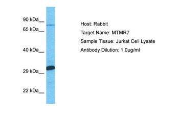 MTMR7 Rabbit Polyclonal Antibody