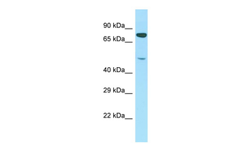 PTCD1 Rabbit Polyclonal Antibody