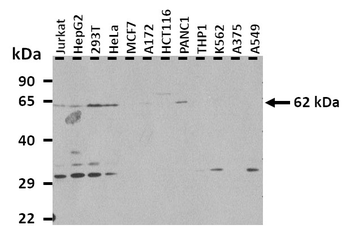 YTHDF2 Rabbit Polyclonal Antibody